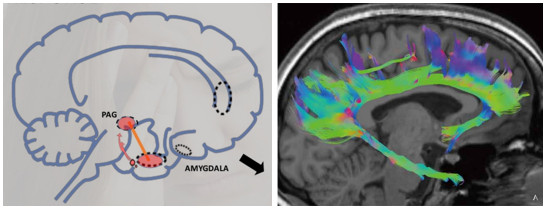 Desde el punto de vista de la neurociencia, las posibles reacciones de la víctima a una situación de inminente peligro, son muy bien conocidas.