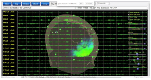 Desde el punto de vista de la neurociencia, las posibles reacciones de la víctima a una situación de inminente peligro, son muy bien conocidas.