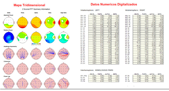 ¿Qué es una base de datos?