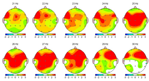 tratamiento-alcoholismo-neurofeedback