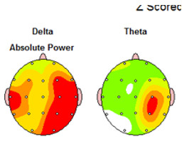 tratamiento-lesiones-cerebrales-neurofeedback