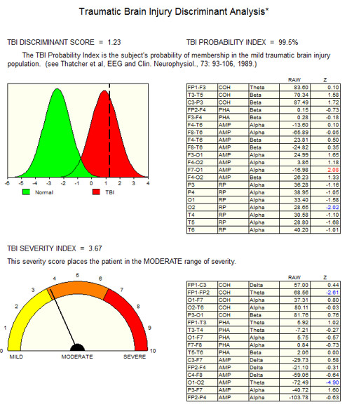 tratamiento-lesiones-cerebrales-neurofeedback