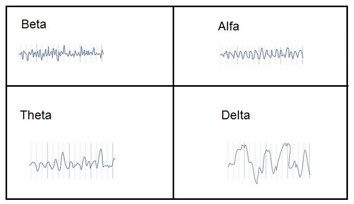 Las ondas cerebrales son un reflejo directo de la función del Sistema Nervioso Central.