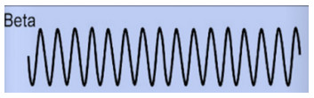 Las ondas cerebrales son un reflejo directo de la función del Sistema Nervioso Central.