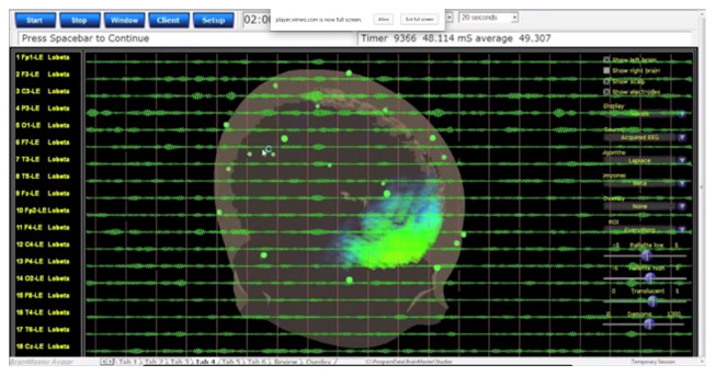 Imagen gráfica sobre neurofeedback