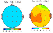 tratamiento-trauma-emocional-neurofeedback